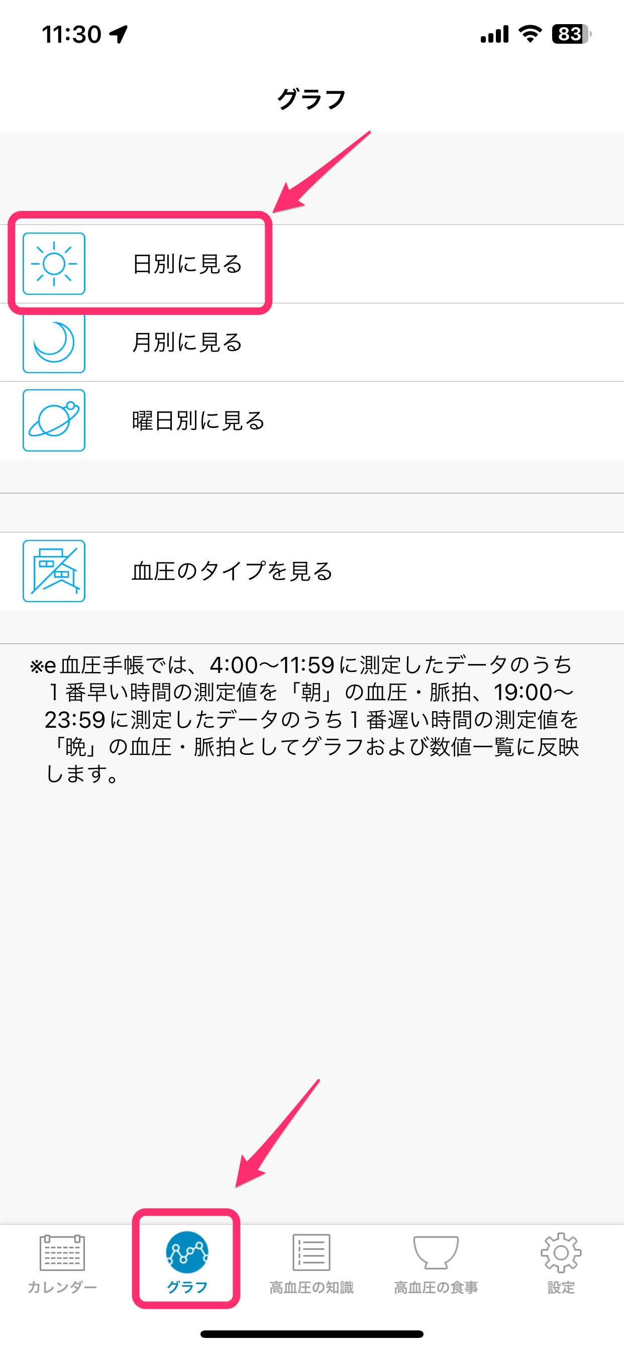グラフ